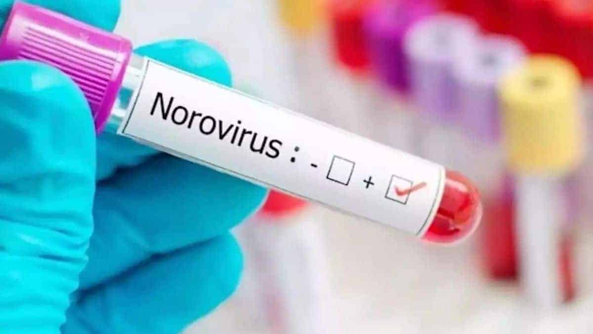 Two cases of norovirus have been confirmed in Kerala, with different symptoms to be aware of