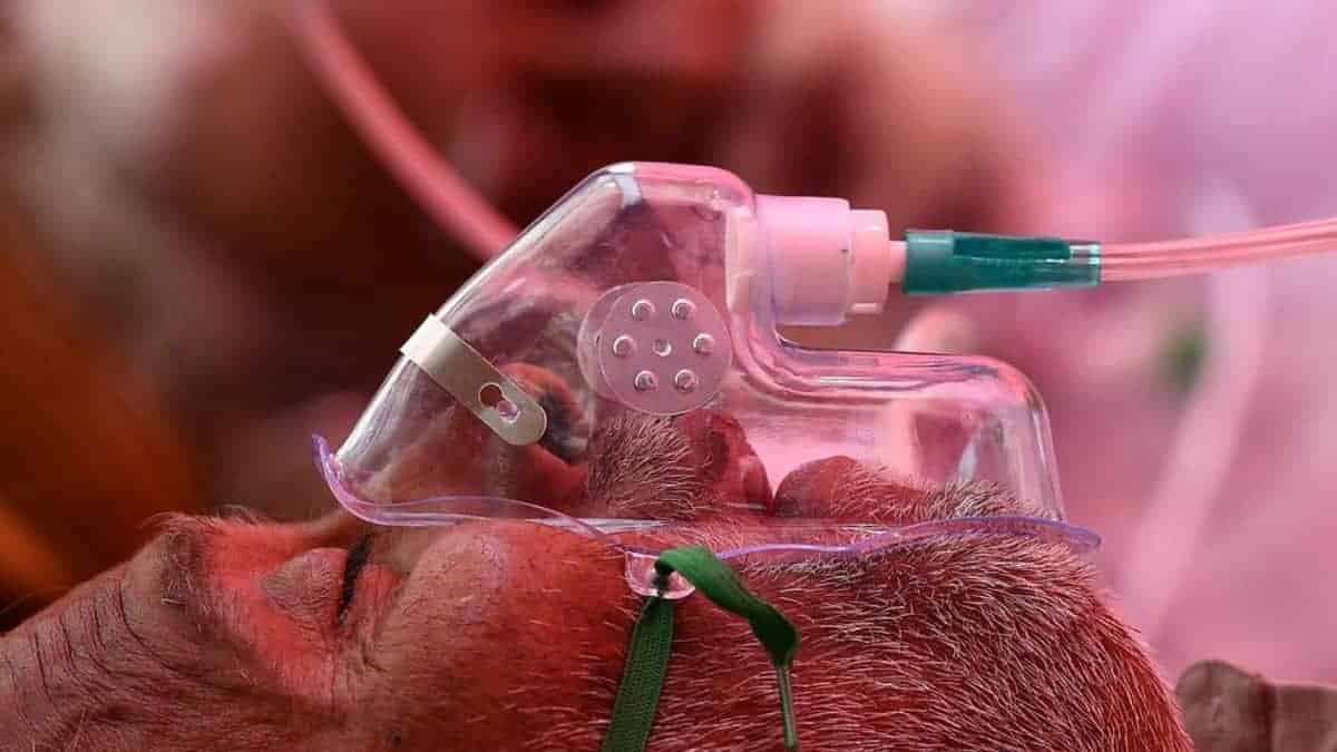 According to Allahabad High Court, if a patient with COVID-19 virus dies from another reason while receiving treatment, it was still caused by the virus