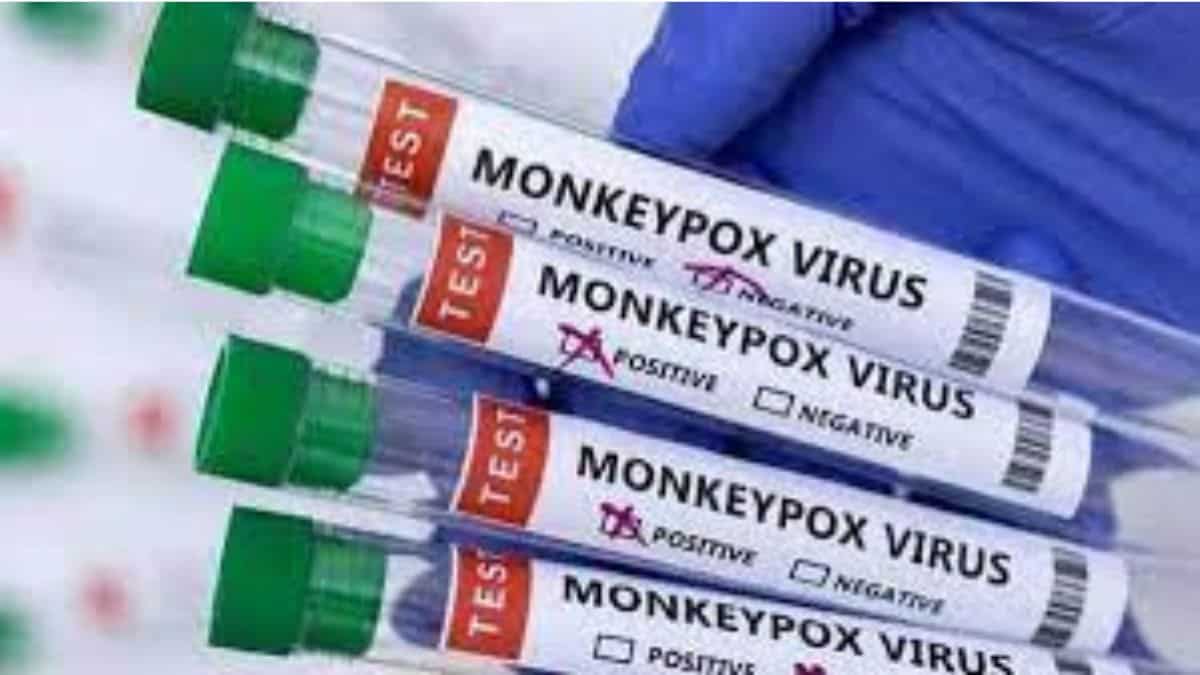 As per the experts, the government is prepared and watchful against monkeypox