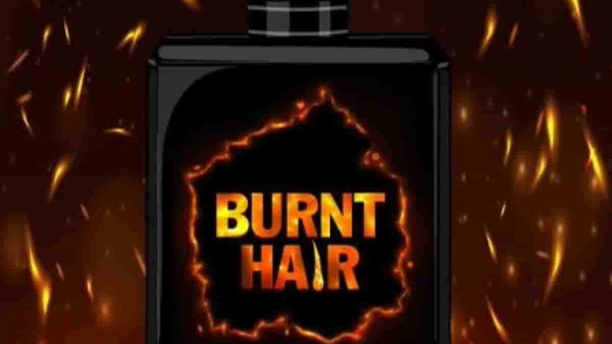 Elon Musk Burnt Hair