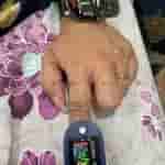 SPO2 Test