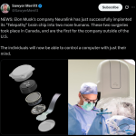 Neuralink Implants its 'Telepathy' Brain Chip into Two More Humans in Canada - X Post (1)